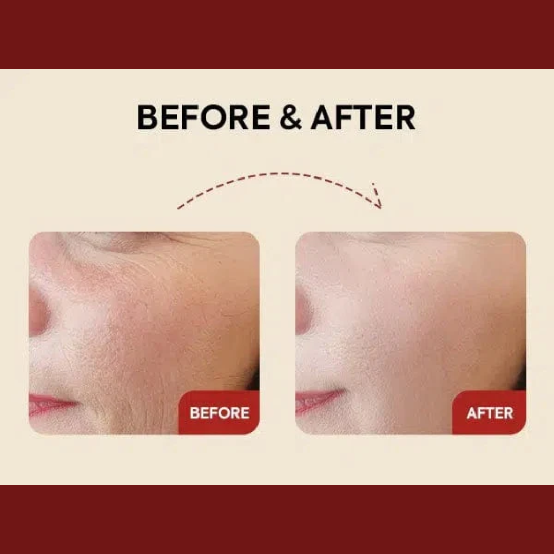 SEOUL 1988 Serum: Retinal + Black Ginseng (Glow, Firm, and Smooth – All in One Bottle)