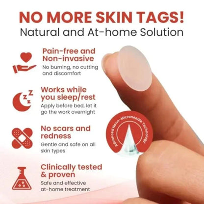 Skin Tag Removal