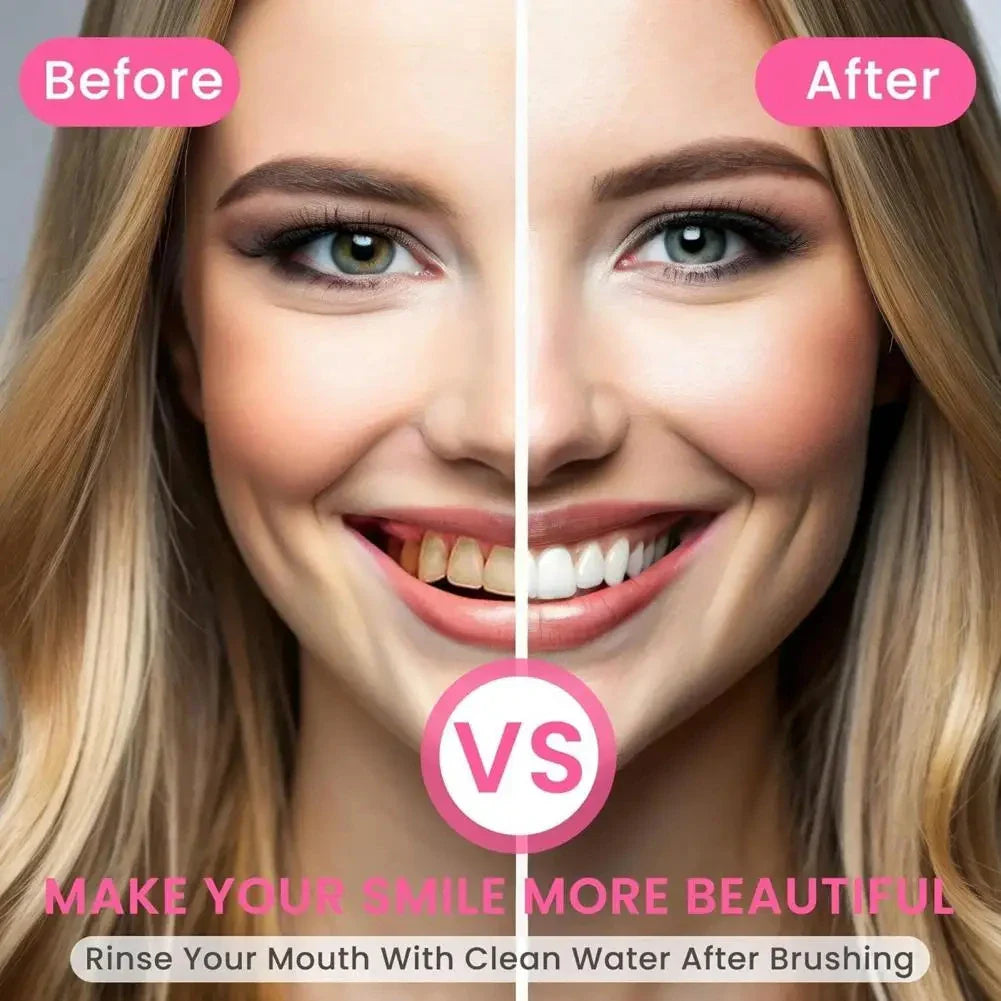 Oralhoe Nicotinamide Dazzle White Toothpaste – 100g Brightening Toothpaste with Niacinamide & Menthol for Deep Stain Removal & Fresh Breath