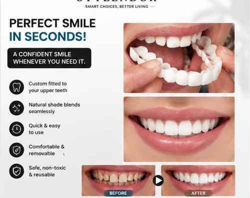 Snap on Smile