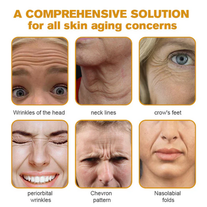 Botox Bee Venom Wrinkle Removal Cream