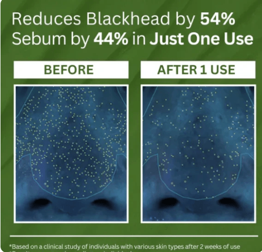 Side by side before and after close-up of pores and skin texture